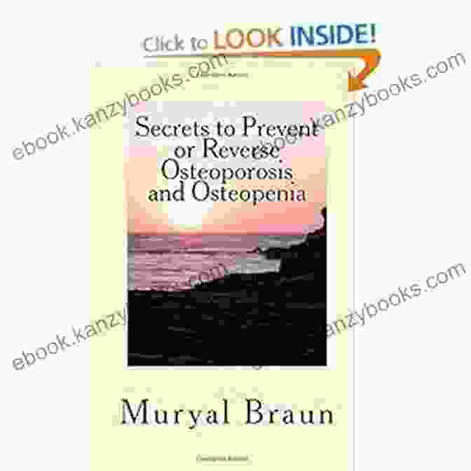 Secrets To Prevent Or Reverse Osteoporosis And Osteopenia Book Cover 7 Secrets To Prevent Or REVERSE Osteoporosis And Osteopenia