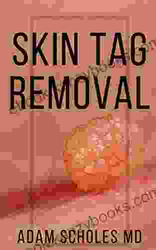 SKIN TAG REMOVAL