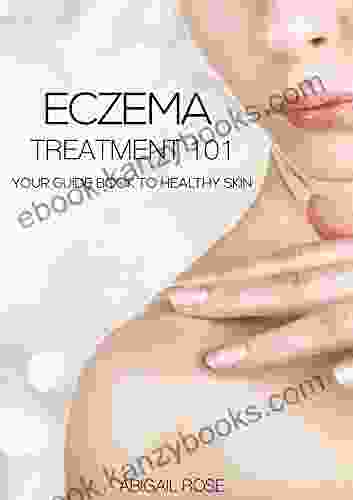 Eczema Treatment 101: Your Guide To Healthy Skin (Beauty Skin Treatments Eczema Edition 1)